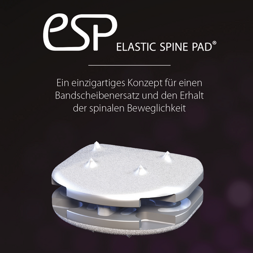 Via4Spine - ESP - Produktbroschüre zum Download