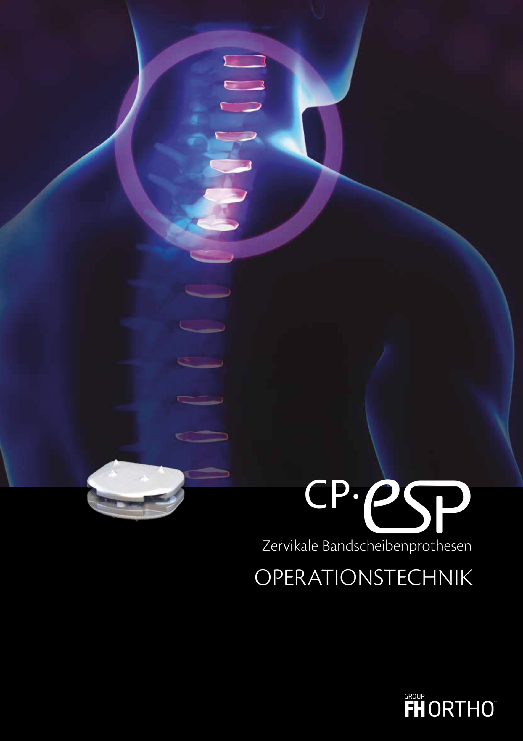 Via4Spine - CP-ESP - OP-TECHNIK BROSCHÜRE IN DEUTSCH ZUM DOWNLOAD