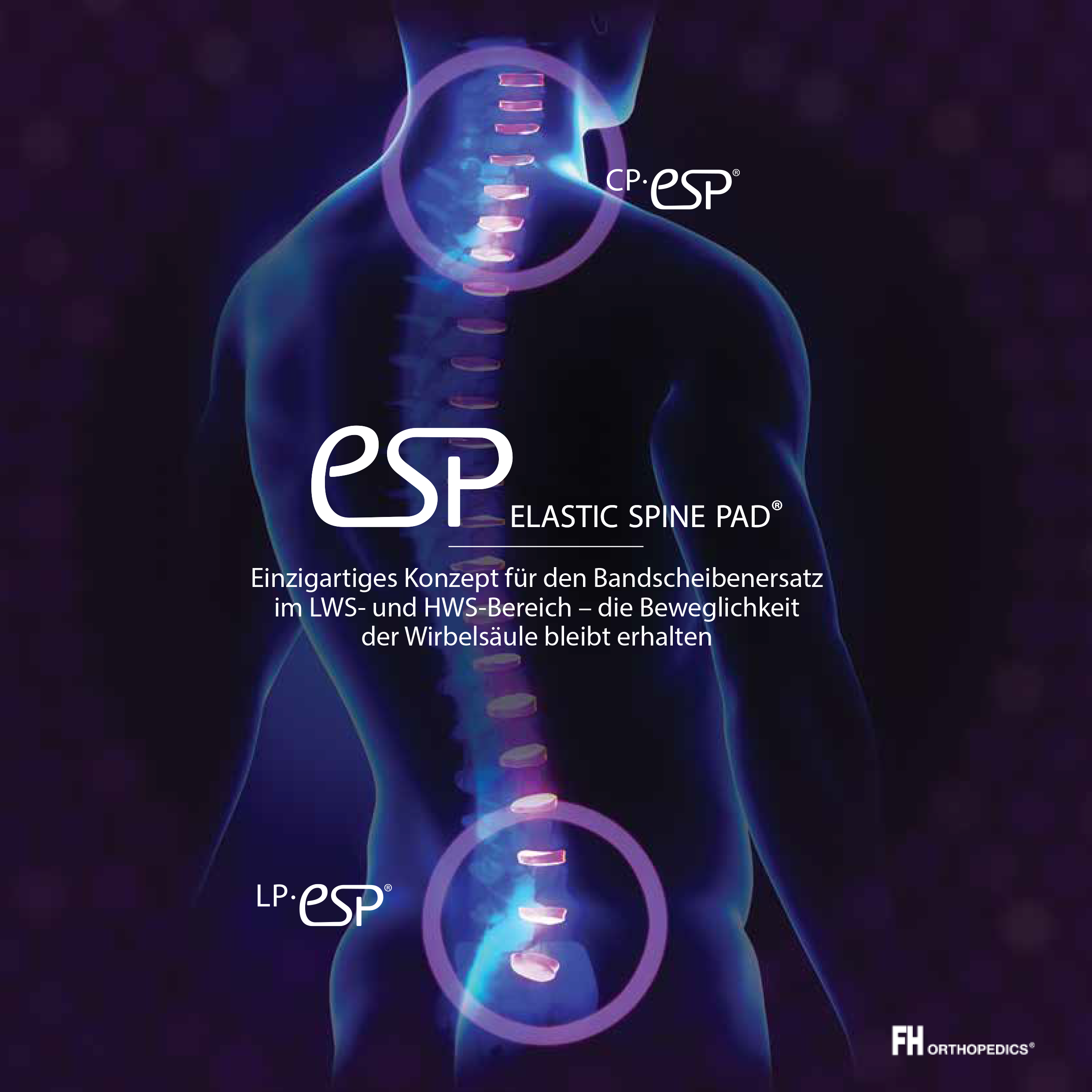 Via4Spine - ESP - Broschüre zum Download